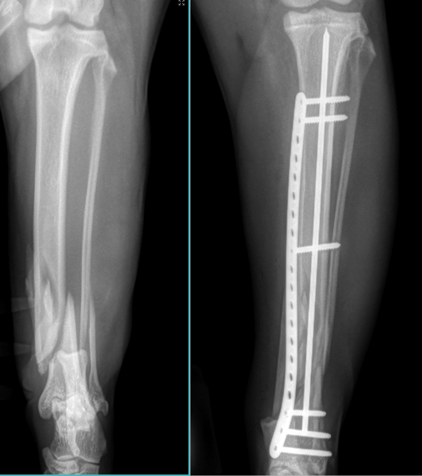 Orthopedic X-Ray