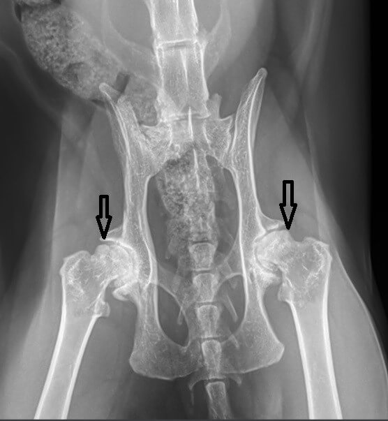 broken hip x ray