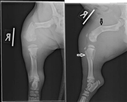 pre op X ray images