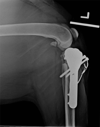 The post op X rays of Duchess reveal the placement of the plate and various screws